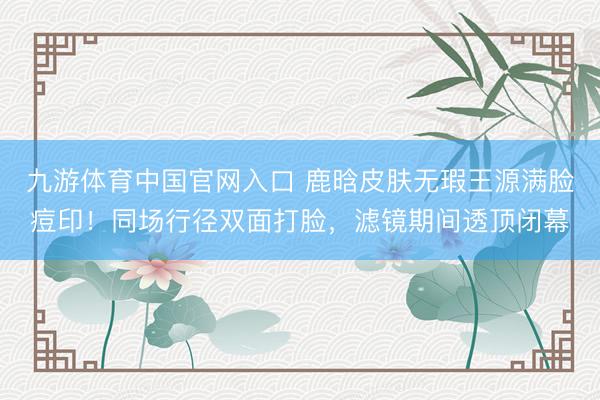 九游体育中国官网入口 鹿晗皮肤无瑕王源满脸痘印！同场行径双面打脸，滤镜期间透顶闭幕